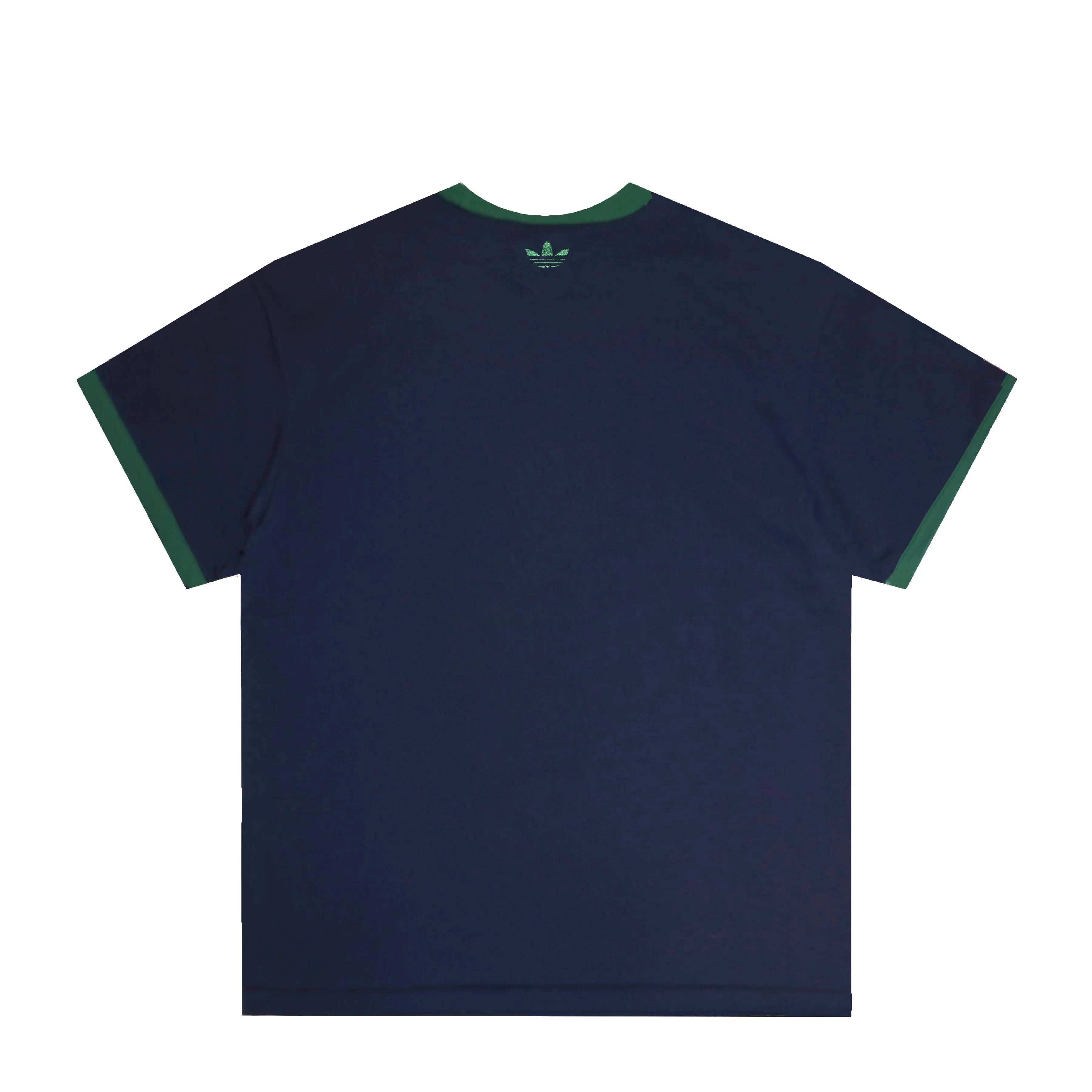 TEE / BRAIN DEAD