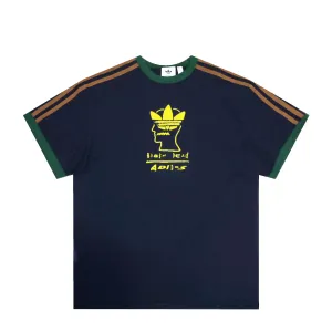 TEE / BRAIN DEAD